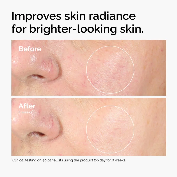 The Ordinary Alpha Arbutin 2% + HA The Ordinary Alpha Arbutin 2% + HA