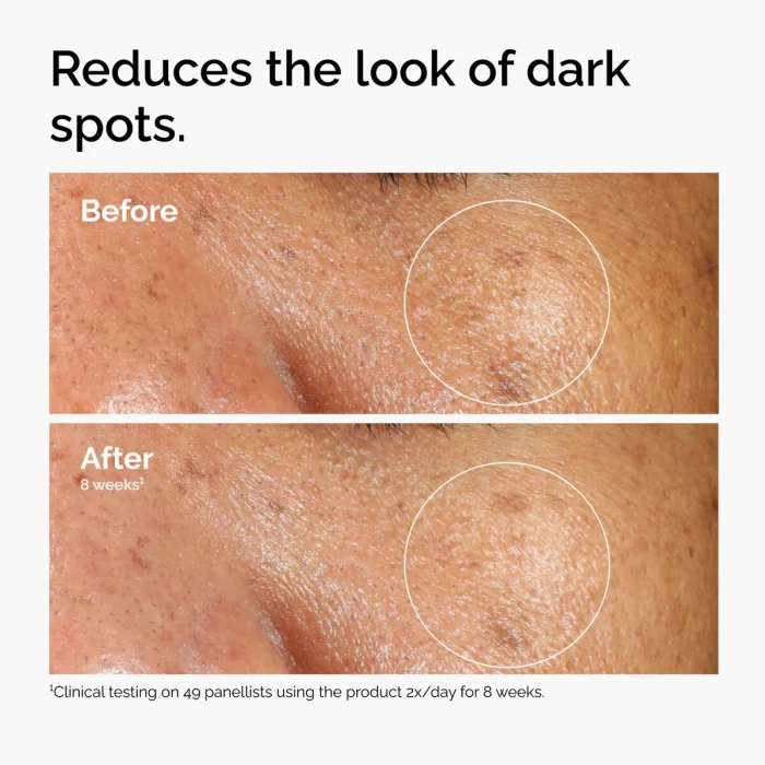 The Ordinary Alpha Arbutin 2% + HA The Ordinary Alpha Arbutin 2% + HA