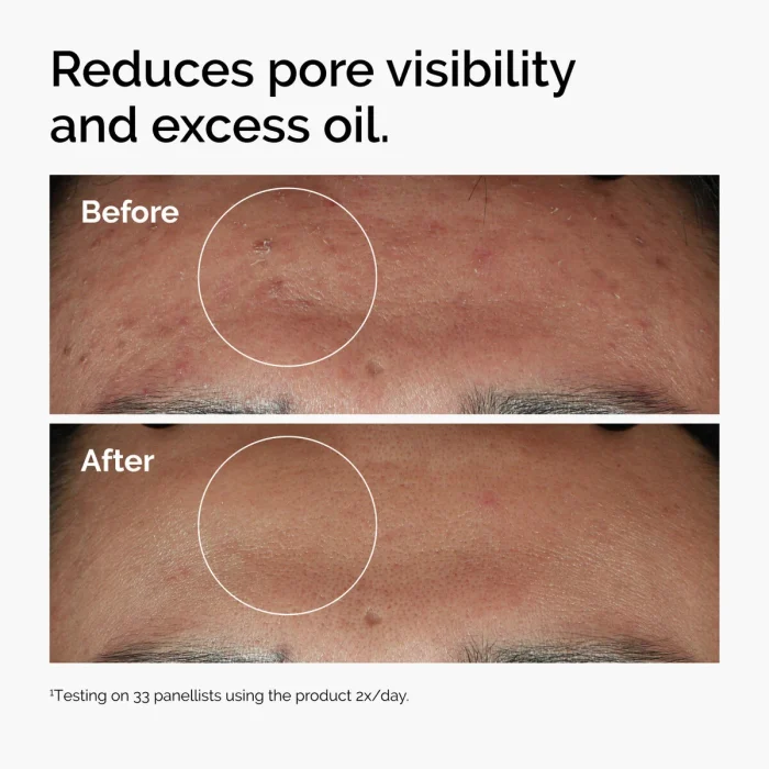 The Ordinary Niacinamide 10% + Zinc 1% The Ordinary Niacinamide 10% + Zinc 1%