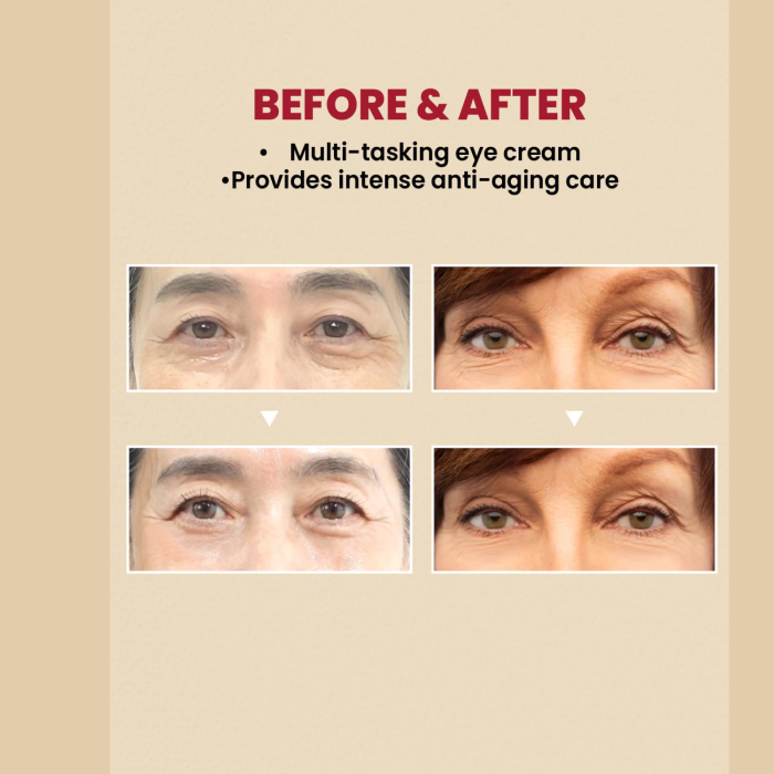 KSECRET SEOUL 1988 Eye Cream - Retinal Liposome 4% + Fermented Bean 3 KSECRET SEOUL 1988 Eye Cream - Retinal Liposome 4% + Fermented Bean | Before & After Usage