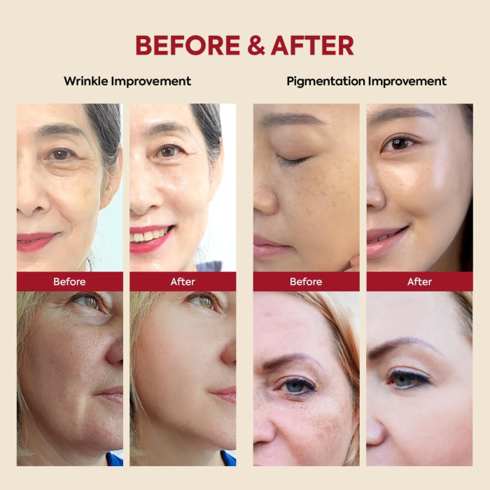 KSECRET Seoul 1988 Serum Retinal Liposome 2% + Black Ginseng 3 K-SECRET Seoul 1988 Serum Retinal Liposome 2% + Black Ginseng - Before and After Usage