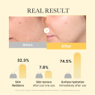 Medicube Kojic Acid Turmeric Gold Jelly Gel Mask | Before and After Results
