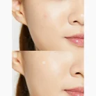 COSRX Acne Pimple Master Patch