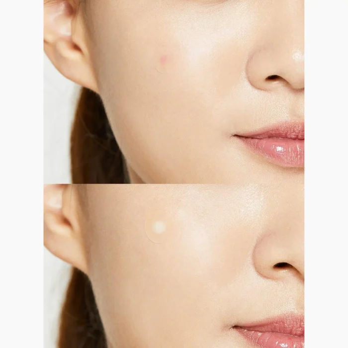 COSRX Acne Pimple Master Patch COSRX Acne Pimple Master Patch