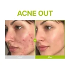 Purito - Azelaic Acid 10 Kojic Tea Tree Serum 2