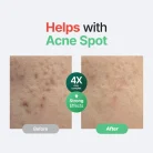 Purito SEOUL - Wonder Releaf Centella Serum Unscented 2