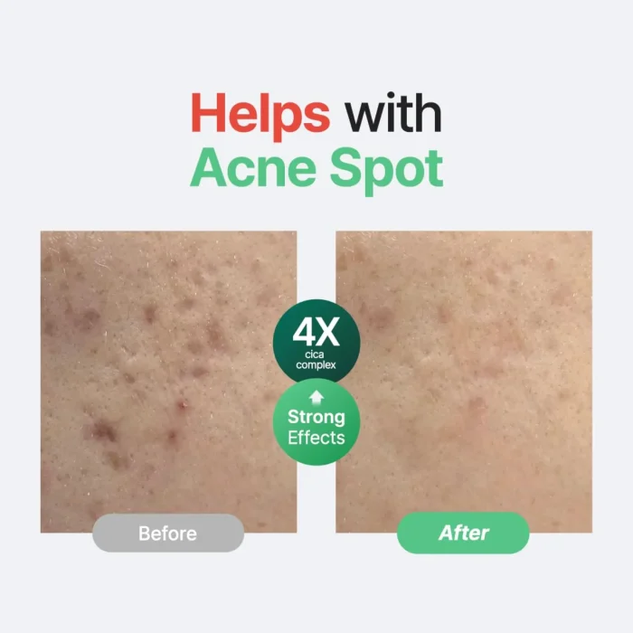 Purito SEOUL - Wonder Releaf Centella Serum Unscented 2 Purito SEOUL - Wonder Releaf Centella Serum Unscented 2