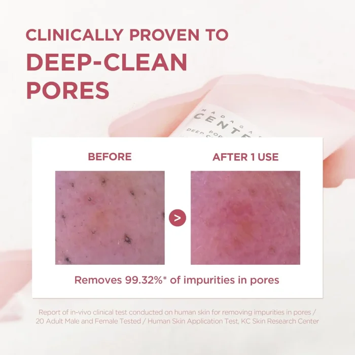 SKIN 1004 - Madagascar Centella Poremizing Deep Cleansing Foam 6 SKIN 1004 - Madagascar Centella Poremizing Deep Cleansing Foam 6