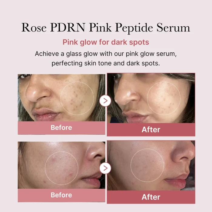 medicube - PDRN Pink Peptide Serum 3 medicube - PDRN Pink Peptide Serum 3