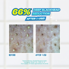 JUMISO - Blackhead Melting Softener 2