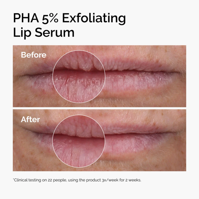 The Ordinary - PHA 5% Exfoliating Lip Serum 2