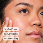 The Ordinary Salicylic Acid 2% Solution 2