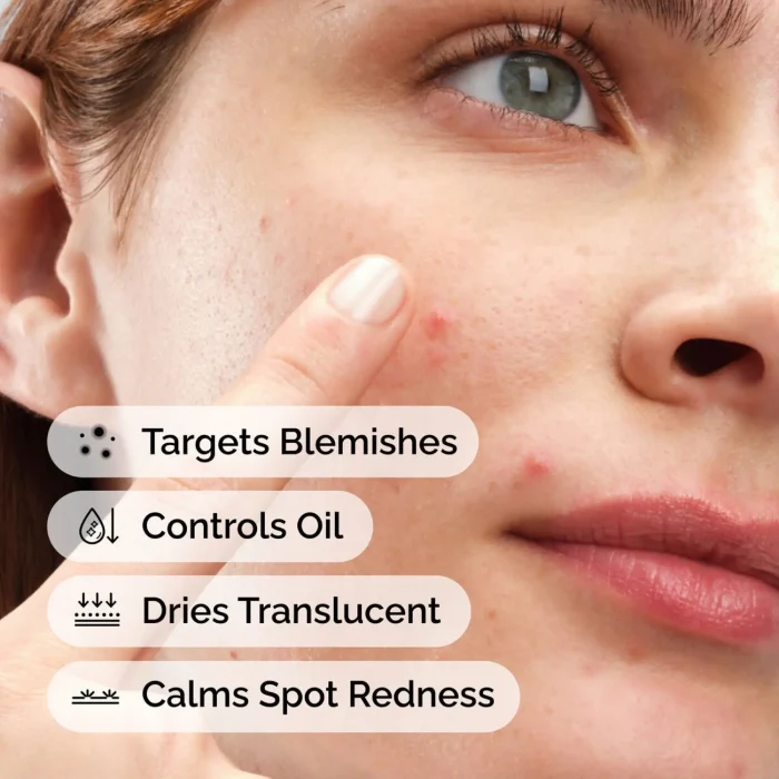The Ordinary - Sulfur 10% Powder-to-Cream Concentrate 2 The Ordinary - Sulfur 10% Powder-to-Cream Concentrate 2