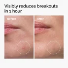 The Ordinary - Sulfur 10% Powder-to-Cream Concentrate 3