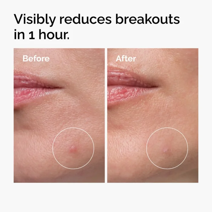 The Ordinary - Sulfur 10% Powder-to-Cream Concentrate 3 The Ordinary - Sulfur 10% Powder-to-Cream Concentrate 3