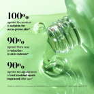 Anua - Azelaic Acid 10 Hyaluron Redness Soothing Serum 3