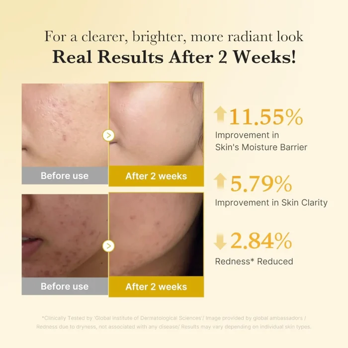 Medicube - Kojic Acid Turmeric Niacinamide Serum 6 Medicube - Kojic Acid Turmeric Niacinamide Serum 6