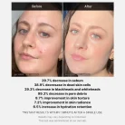 Medicube - Red Acne Succinic Acid Peel 3