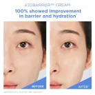 Aestura - AtoBarrier 365 Cream 2