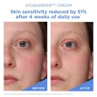 Aestura - AtoBarrier 365 Cream 3