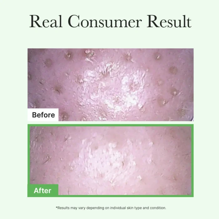 Arencia - Pore Melt Mochi Cleansing Oil 3