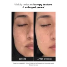 Paula's Choice - Niacinamide 20% Treatment 5