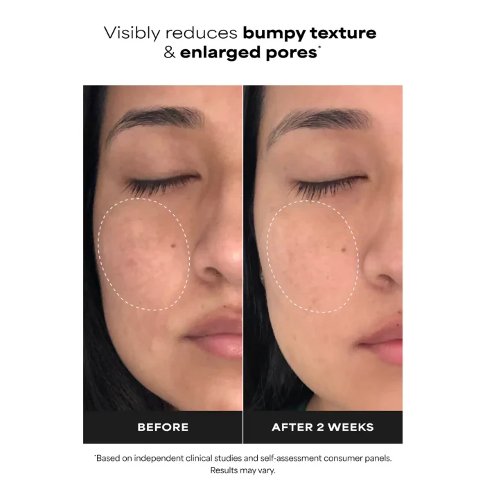 Paula's Choice - Niacinamide 20% Treatment 5 Paula's Choice - Niacinamide 20% Treatment 5