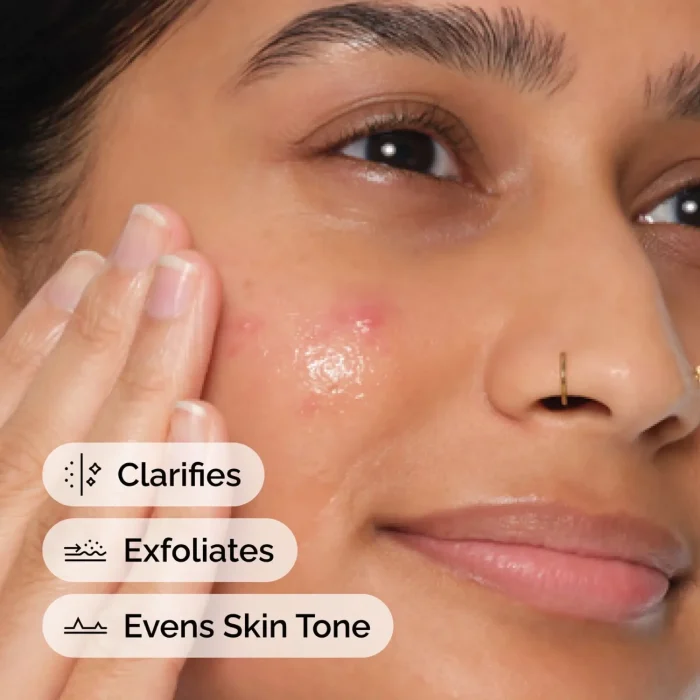 The Ordinary - Salicylic Acid 2% Anhydrous Solution 2 The Ordinary - Salicylic Acid 2% Anhydrous Solution 2