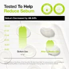 Anua - Ultra-Thin Spot Cover Patch 3