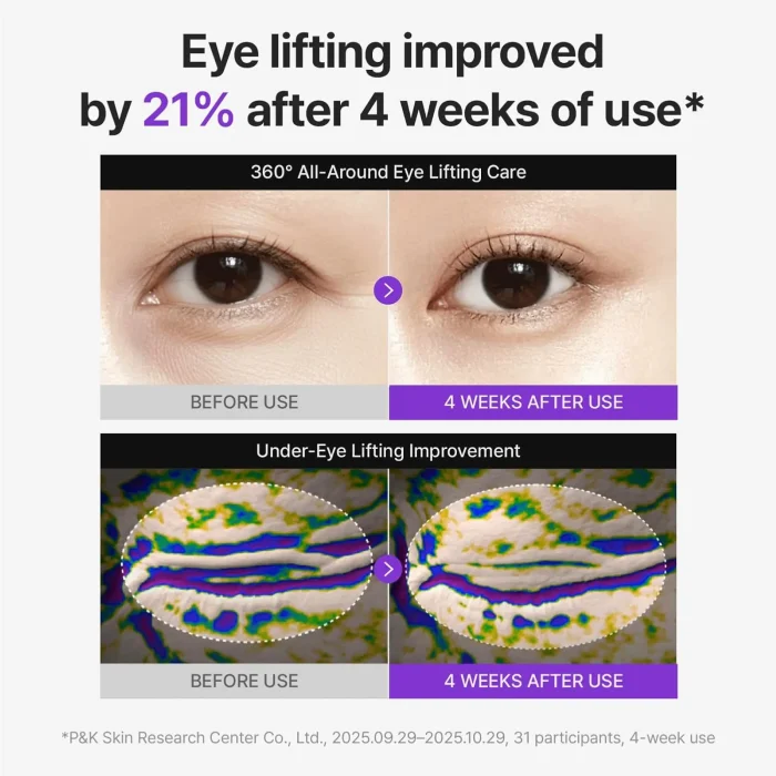 Centellian24 - 360º Shot PDRN Lifting Eye Cream 4