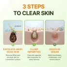 Centellian24 - Madeca Matcha Toning Peeling Gel 6