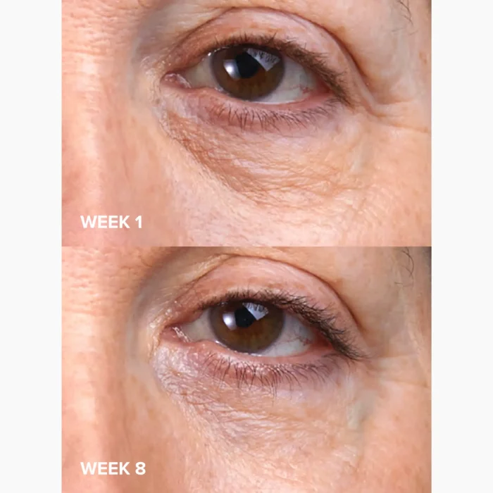 Paula's Choice - C5 Super Boost Eye Cream 15 ML 8