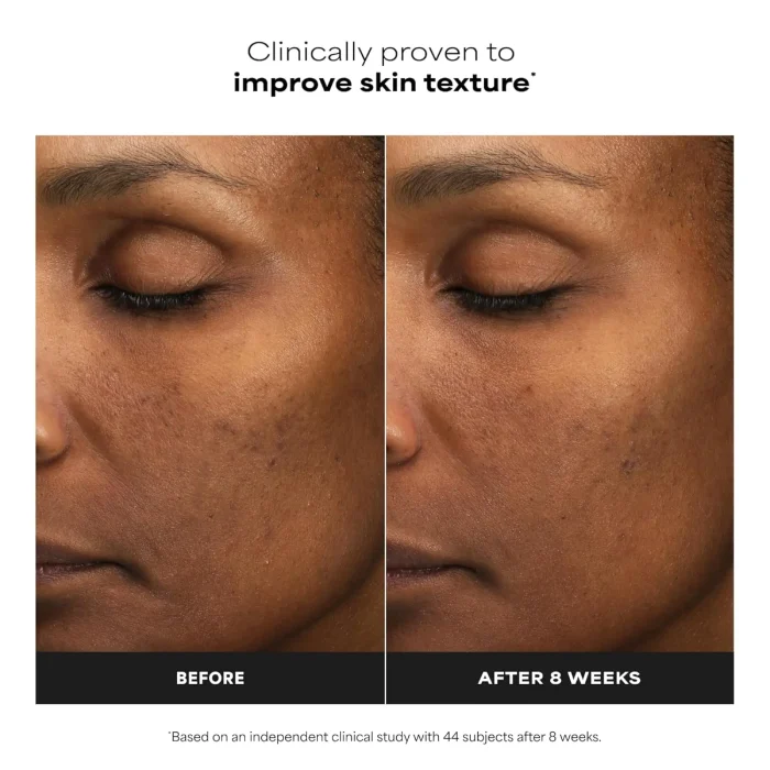 Paula's Choice - Skin Perfecting 6% Mandelic Acid + 2% Lactic Acid AHA Exfoliator 6 Paula's Choice - Skin Perfecting 6% Mandelic Acid + 2% Lactic Acid AHA Exfoliator 6
