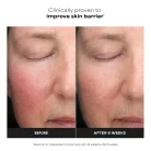 Paula's Choice - Skin Perfecting 6% Mandelic Acid + 2% Lactic Acid AHA Exfoliator 8