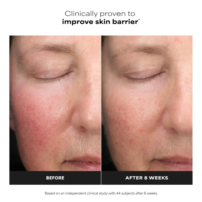 Paula's Choice - Skin Perfecting 6% Mandelic Acid + 2% Lactic Acid AHA Exfoliator 8 Paula's Choice - Skin Perfecting 6% Mandelic Acid + 2% Lactic Acid AHA Exfoliator 8