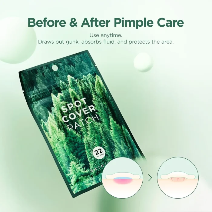 SKIN1004 - Tea-Trica Spot Cover Patch - 1 Pack (22EA) 2