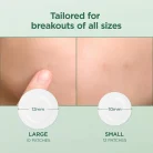 SKIN1004 - Tea-Trica Spot Cover Patch - 1 Pack (22EA) 5