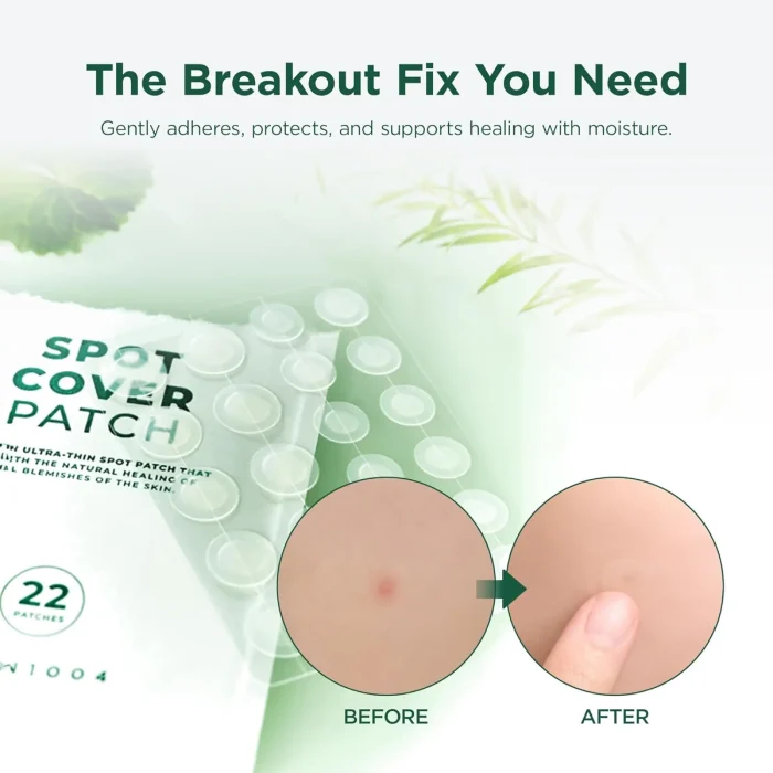 SKIN1004 - Tea-Trica Spot Cover Patch - 1 Pack (22EA) 6