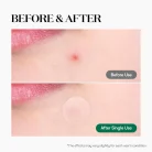 VT Cosmetics - Cica Care Spot 3