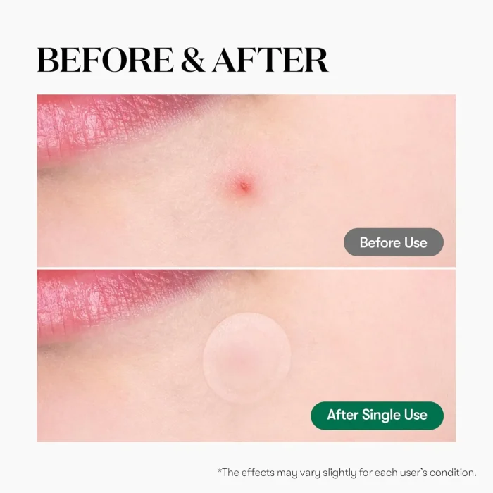 VT Cosmetics - Cica Care Spot 3 VT Cosmetics - Cica Care Spot 3