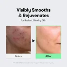 VT Cosmetics - Reedle Shot 300 6